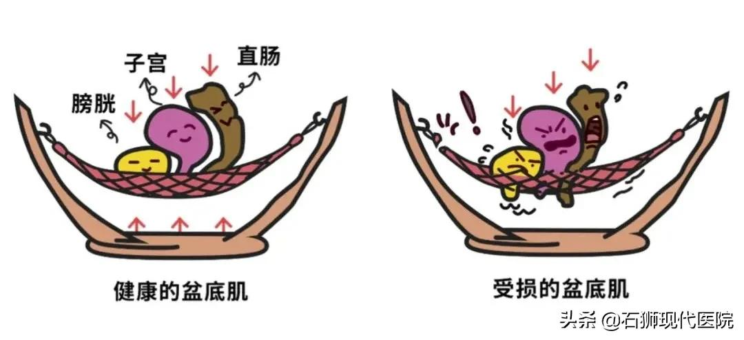 产后想要做健康辣妈，这些雷区要记得避开哦