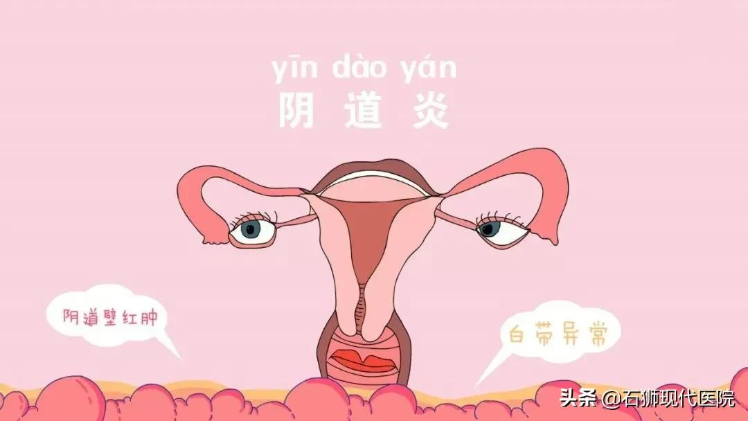 妇科炎症也会传染，大部分女性居然都不知道这些