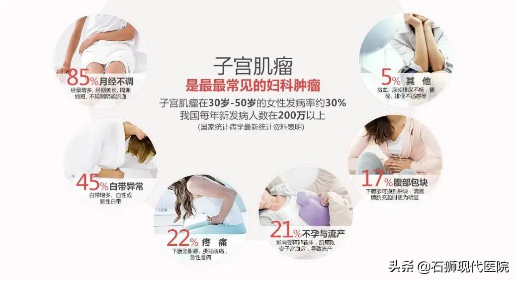 大家好,我是一枚10岁的子宫肌瘤