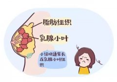 如何正确认识“乳腺结节”？