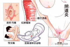 霉菌性阴道炎总是反反复复怎么办？