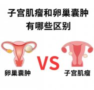 子宫肌瘤？囊肿？有什么区别？症状都